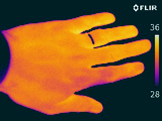 Thermographic images of man's hand