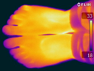 thermographies de pieds humains