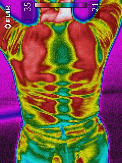 Thermography of the back of a people suffering through his trouser
