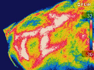 Inflamate knee seen in thermal infrared image
