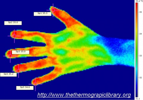thermographic imagery of girl's hands