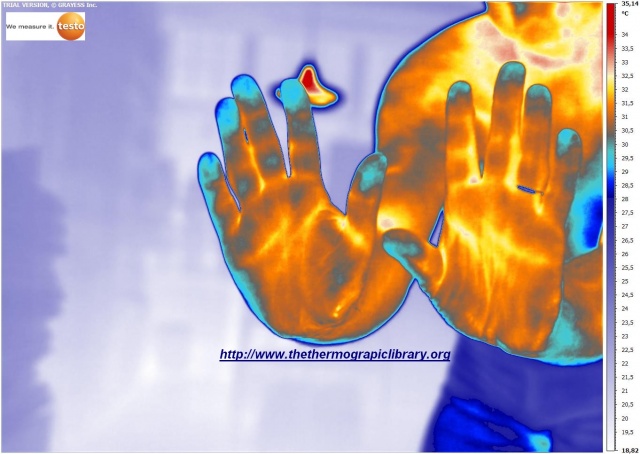 thermal image of hands in high resolution by TESTO890
