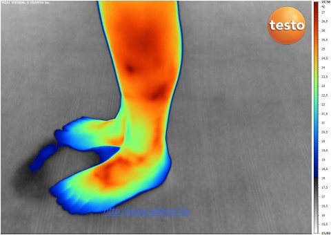 Woman feet thermography