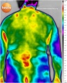 Back-male-thermography-medical.jpg