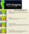 Breast-cancer-thermography.jpg