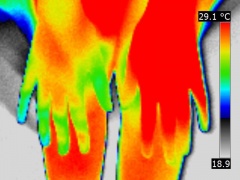 People with bad gesture before medical thermography, irrelevant result, error