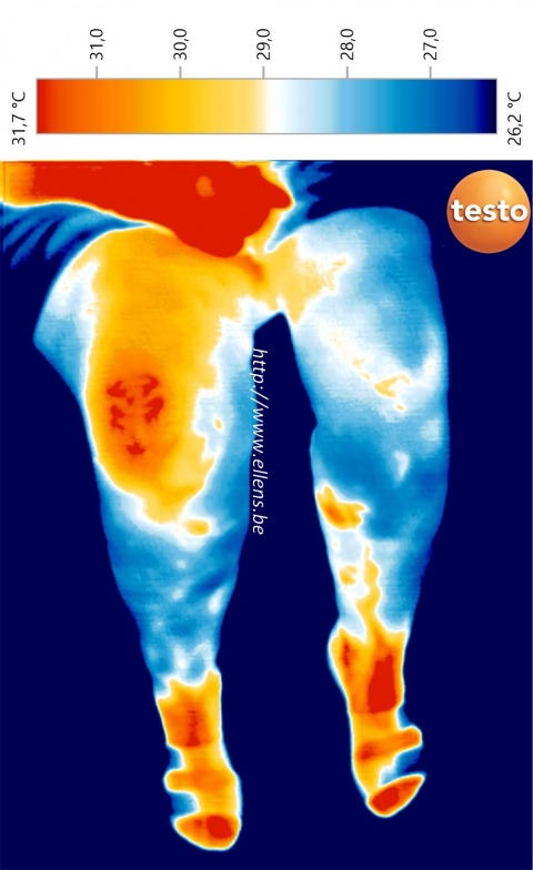 Imagerie thermique infrarouge de jambes gonflées