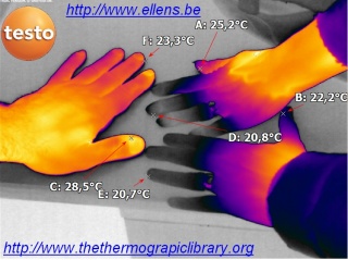 Thermographie comparative de mains masculine et féminines