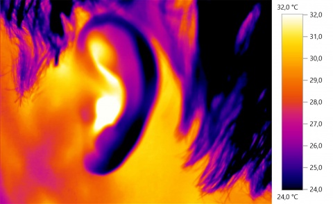 Thermography of a human male ear
