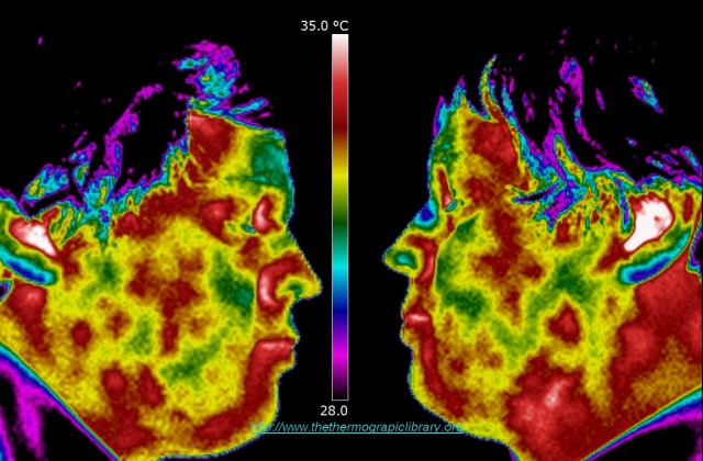 Left and right side of human head compared in thermographic image