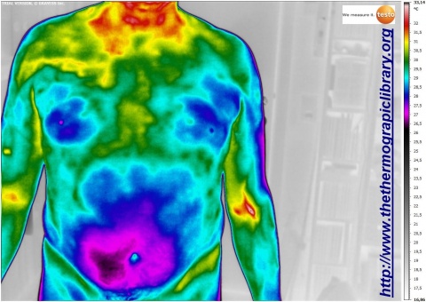 Hepatitis condition in thermography