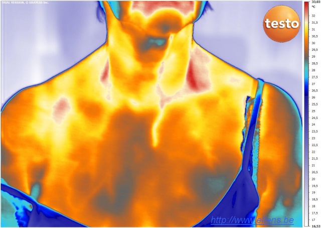 Thermographie en imagerie infrarouge d'un buste de femme