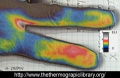 Thermographie-zoom-doigt-medical.jpg