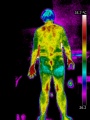 Homme-dos-thermographie.jpg