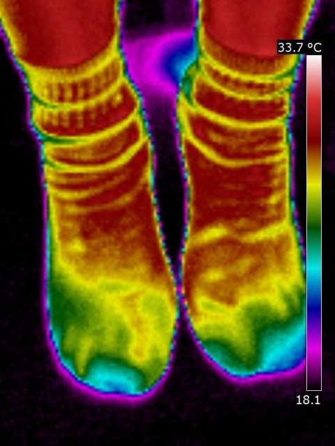 Thermography of feet with socks