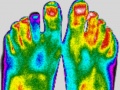 Pieds-fille-thermographie-infrarouge.jpg