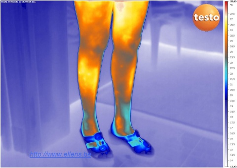 Imagerie thermique médicale de jambes de femme