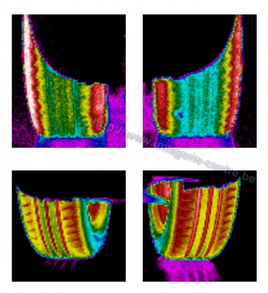 Fichier:Thermographie pneu.jpg