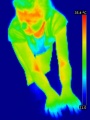 Jeune fille thermographie.jpg