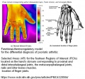 Psoriasis-arthritis-thermographie-infrarouge.jpg