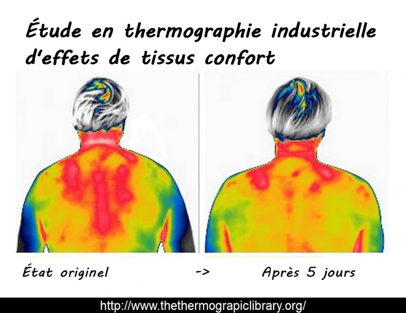 Etude en thermographie industrielle textile d'un tissu confort sur le dos