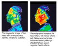 Gsm thermographie tete humaine.png
