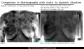 Cancer-thermography-dynamic.jpg