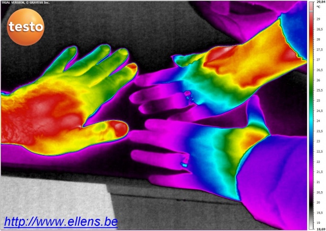 Imagerie thermique infrarouge de mains d'homme et de femme