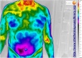 Liver-followup-thermography-testo-890.jpg