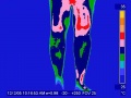 Legs human infrared thermography.jpg