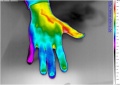 Hand-thermografie-geneeskunde.jpg