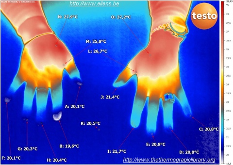 Thermographie médicale de mains de femmes aux doigts extrêmement froids